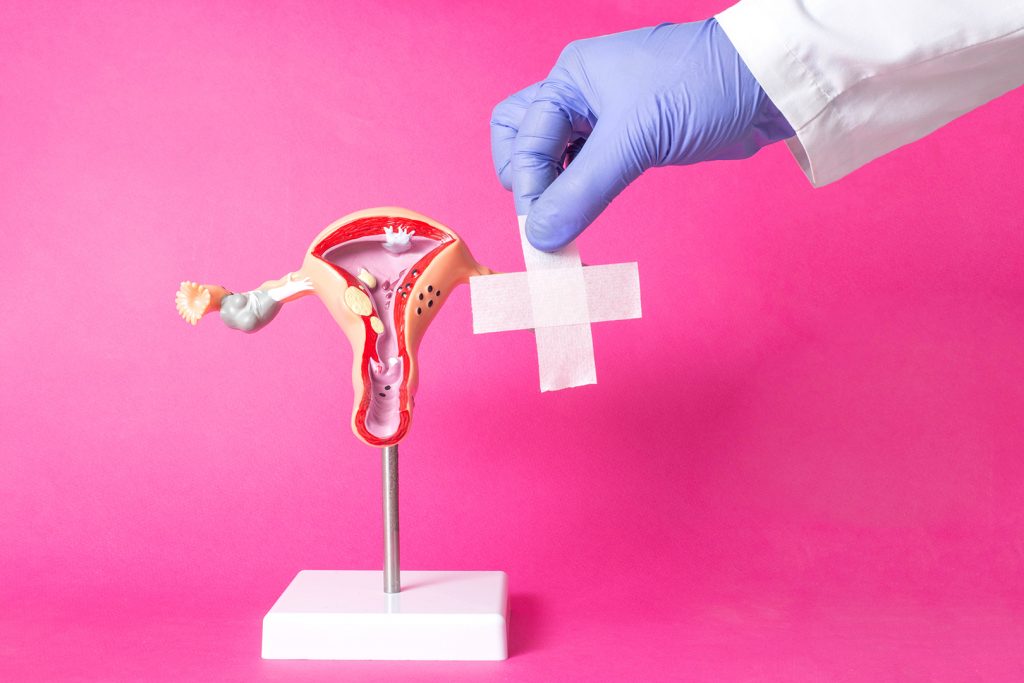bandage-uterus-pinkBG